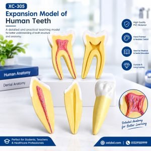 XC-305 human teeth expansion model front view