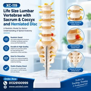 Lumbar Spine Model with Herniated Disc showing the complete vertebral column