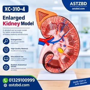 enlarged kidney model